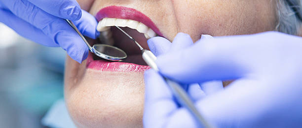 Best Emergency Tooth Extraction  in Wtell, LA